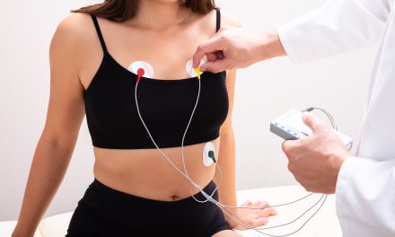 Holter EKG – čemu služi i kako radi