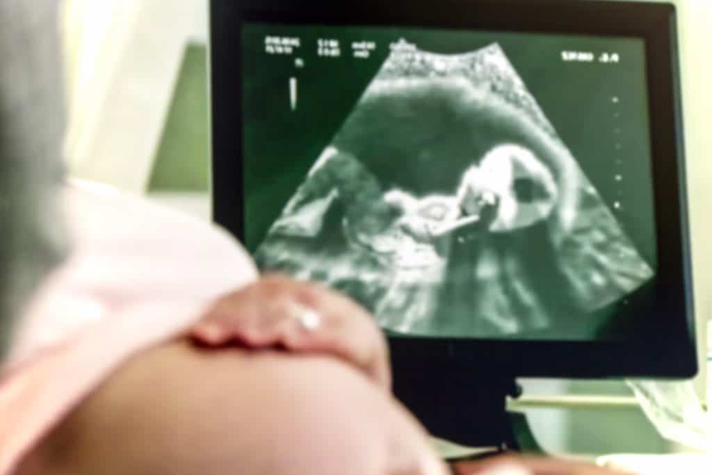 4D, 3D, 2D ultrazvuk u trudnoći - koja je razlika