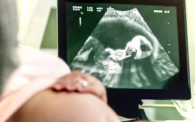 4D, 3D, 2D ultrazvuk u trudnoći – koja je razlika