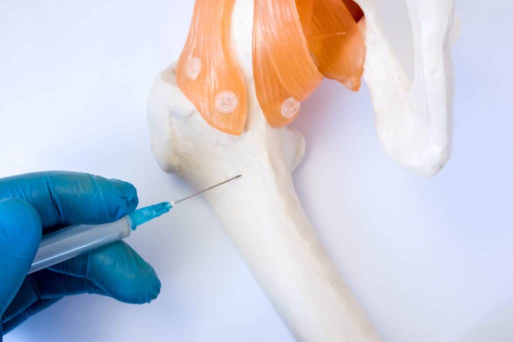 Biopsija kosti - kako i kada se izvodi