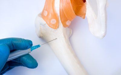 Biopsija kosti – kako i kada se izvodi