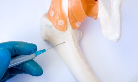 Biopsija kosti – kako i kada se izvodi
