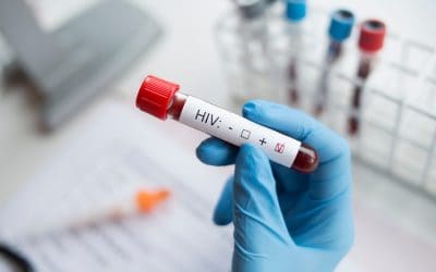 HIV test – kada je potrebno otići na testiranje