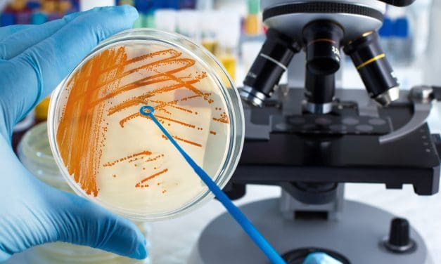 Kako nastaju bakterije u urinu