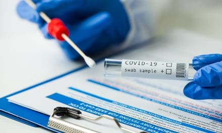 PCR test – što je, kako se radi i koliko košta