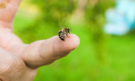 Reakcija na ubod pčele – što napraviti
