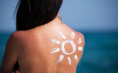 Alergija na sunce – simptomi i liječenje
