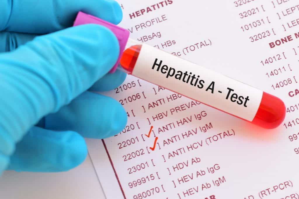 Hepatitis A - uzrok, simptomi i liječenje