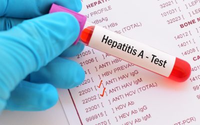 Hepatitis A – uzrok, simptomi i liječenje