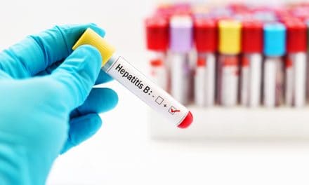 Hepatitis B – uzrok, simptomi i liječenje