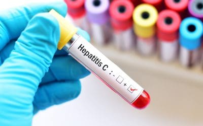 Hepatitis C – uzrok, simptomi i liječenje