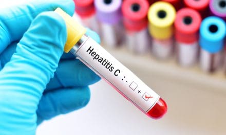 Hepatitis C – uzrok, simptomi i liječenje
