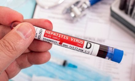Hepatitis D – uzrok, simptomi i liječenje