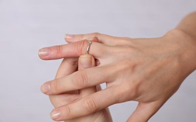 Kako skinuti prsten sa natečenog prsta