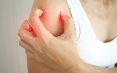 Što je dermatitis – uzroci i liječenje