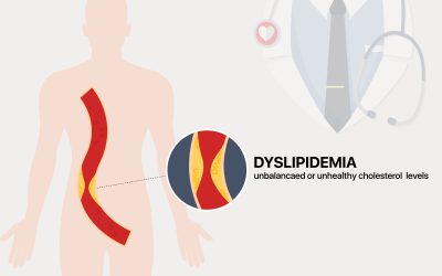 Što je dislipidemija – simptomi i liječenje