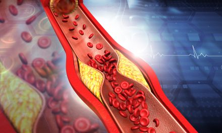 Što je povišen kolesterol – prehrana i liječenje