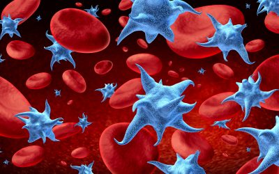 Što je trombocitopenija – simptomi i liječenje