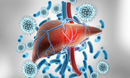 Ciroza jetre – uzrok, simptomi i liječenje
