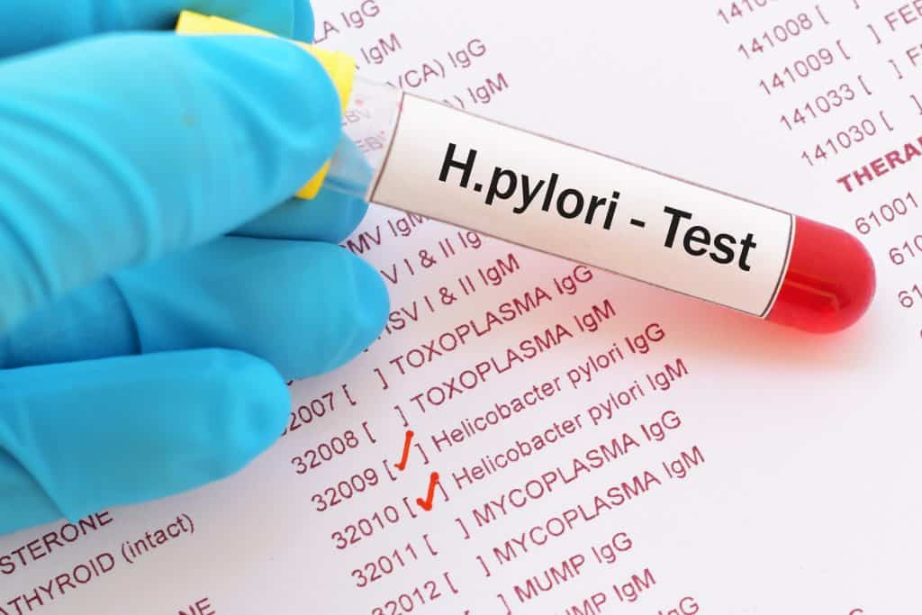 Helicobacter pylori bakterija - simptomi i liječenje infekcije