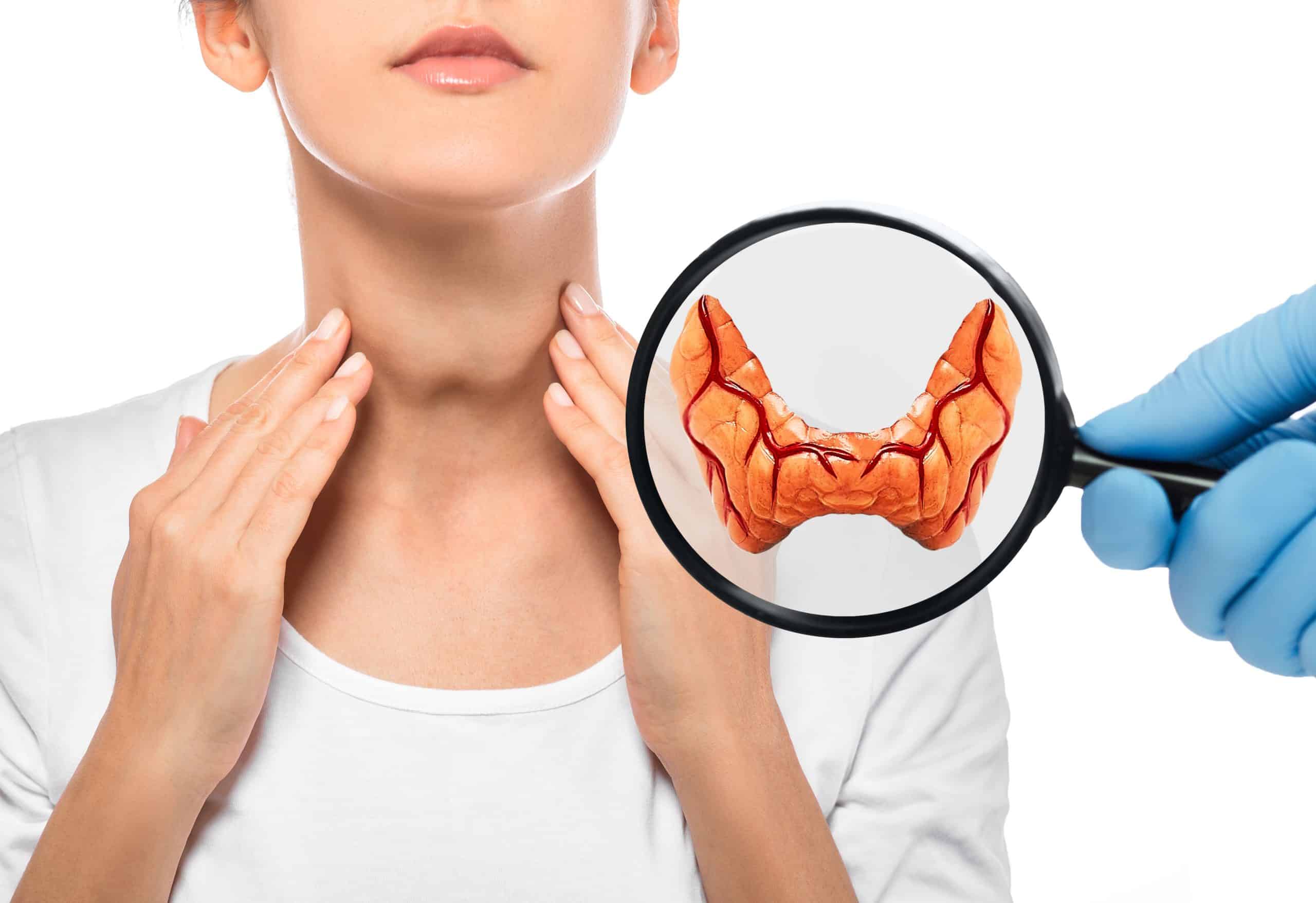 Признаки щитовидки у мужчин лечение. Доктор щитовидная железа.