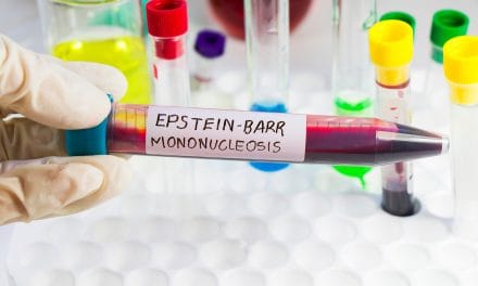 Mononukleoza – simptomi, uzrok i liječenje