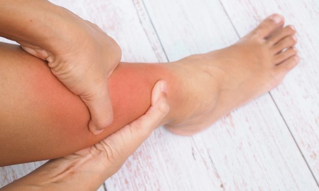 Oticanje nogu – simptomi, uzrok i liječenje