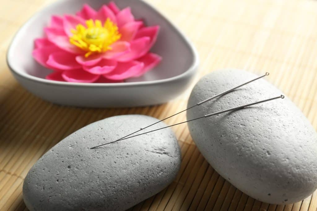 Što je akupunktura i kako se izvodi