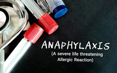 Što je anafilaktički šok – prepoznajte simptome na vrijeme