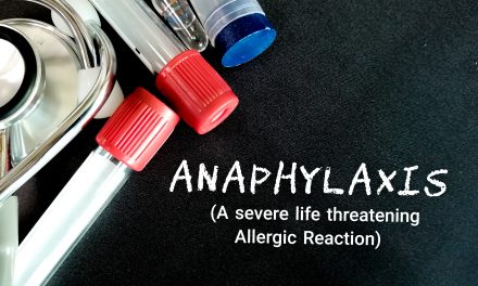 Što je anafilaktički šok – prepoznajte simptome na vrijeme