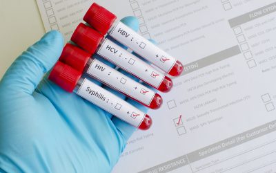 Testiranje na spolne bolesti – gdje i kako se izvodi