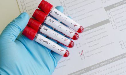 Testiranje na spolne bolesti – gdje i kako se izvodi