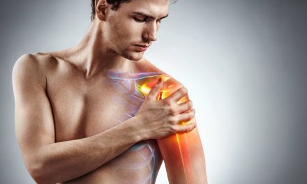 Upala mišića – uzrok, simptomi i liječenje