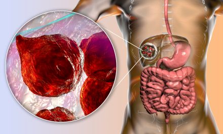Cista na jetri – uzrok, simptomi, liječenje
