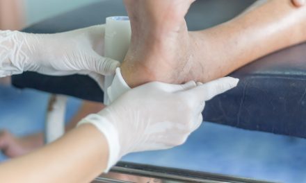 Dijabetičko stopalo – uzrok, simptomi i liječenje