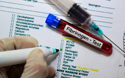 Fibrinogen povišen i snižen – ima li utjecaj na zdravlje