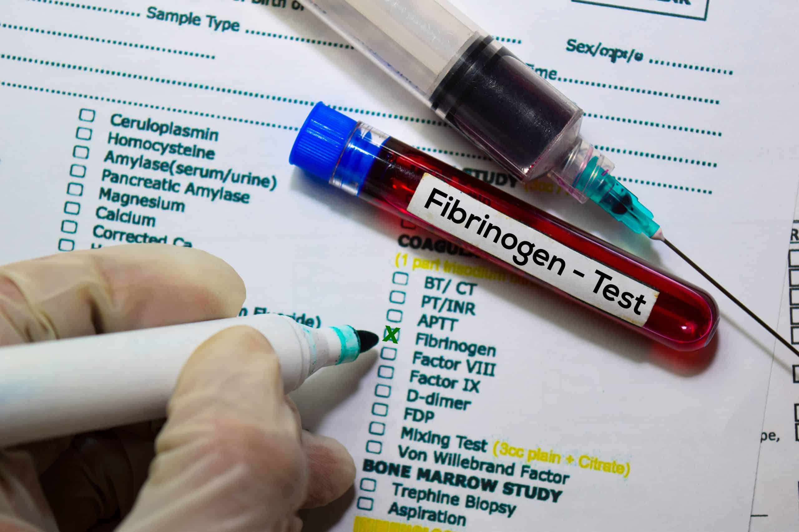 Препарат крови тест. Фибриноген картинки. Фибриноген тест. Забор крови на фибриноген. Фибриноген TB.