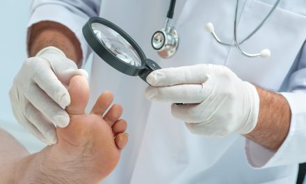 Gljivice na nogama – zašto nastaju i kako liječiti