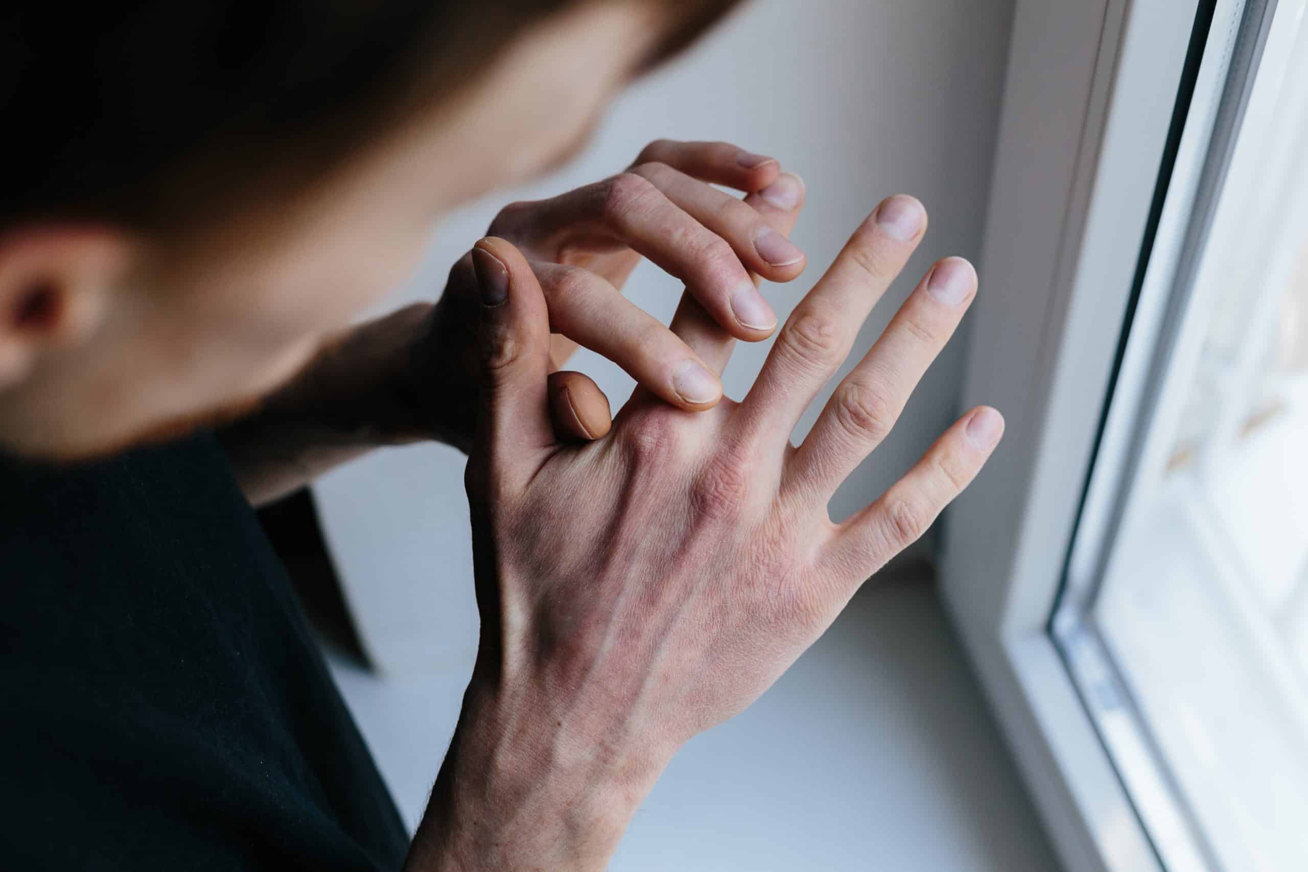 Сохнуть по человеку. Поговорки про толстых. Презентация на тему зависть. Кератодермия гиперкератоз. Кожаные заболевания на руках.