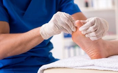 Gljivice na stopalima – uzrok, simptomi i liječenje