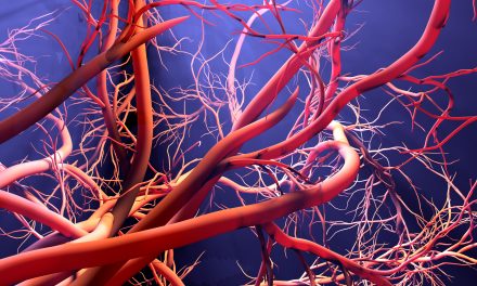 Kako očistiti krvne žile prirodnim putem