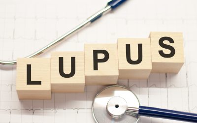 Kako prepoznati lupus