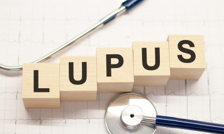 Kako prepoznati lupus