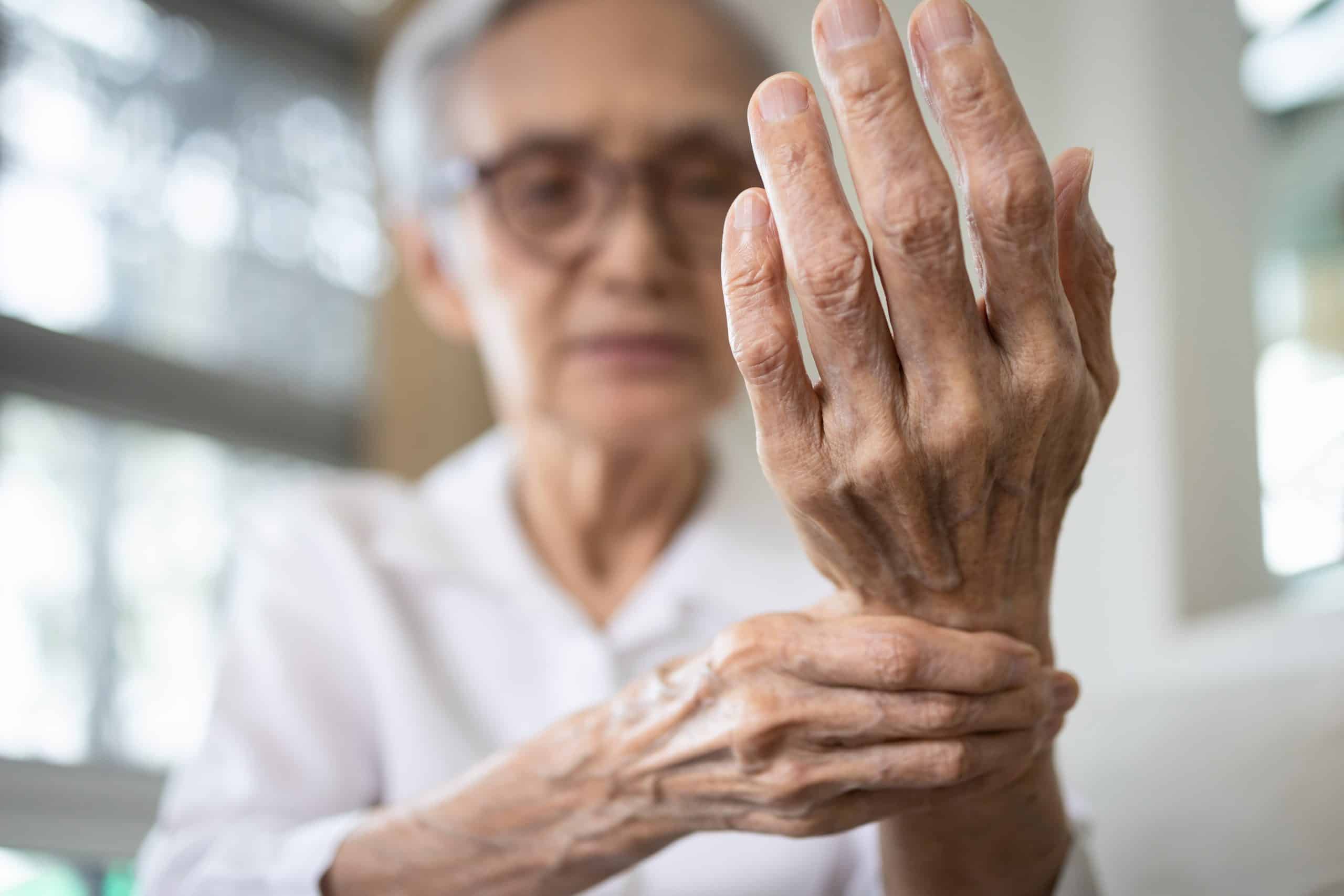 svi lijekovi za artrozu boli zglobovi ruku i nogu