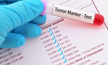 Tumorski markeri – što su i kako se rade