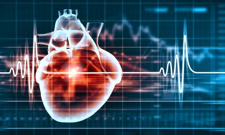 Jaki otkucaji srca – uzrok, simptomi i liječenje