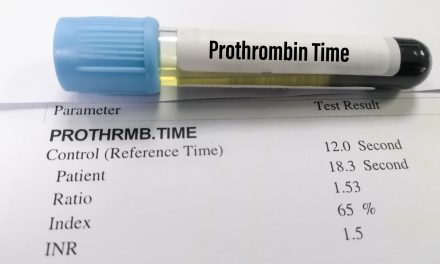 Protrombinsko vrijeme – što je i kako se izvodi test
