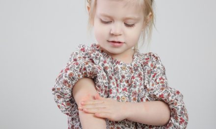 Psorijaza kod djece – uzrok, sipmtomi, liječenje