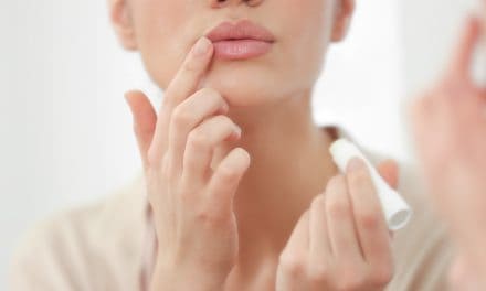 Trnjenje usana i jezika – uzrok i liječenje