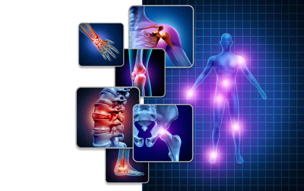 Artritis liječenje - uzrok, simptomi i liječenje